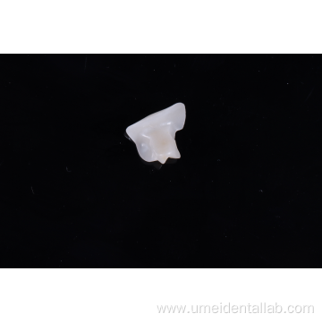 Zirconia Inlay